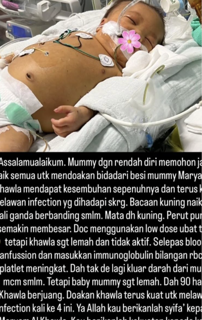 anak kembar